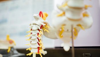 A Protocol of Accelerated Rehabilitation following surgery for adolescent Idiopathic Scoliosis (PARIS) - a feasibility study